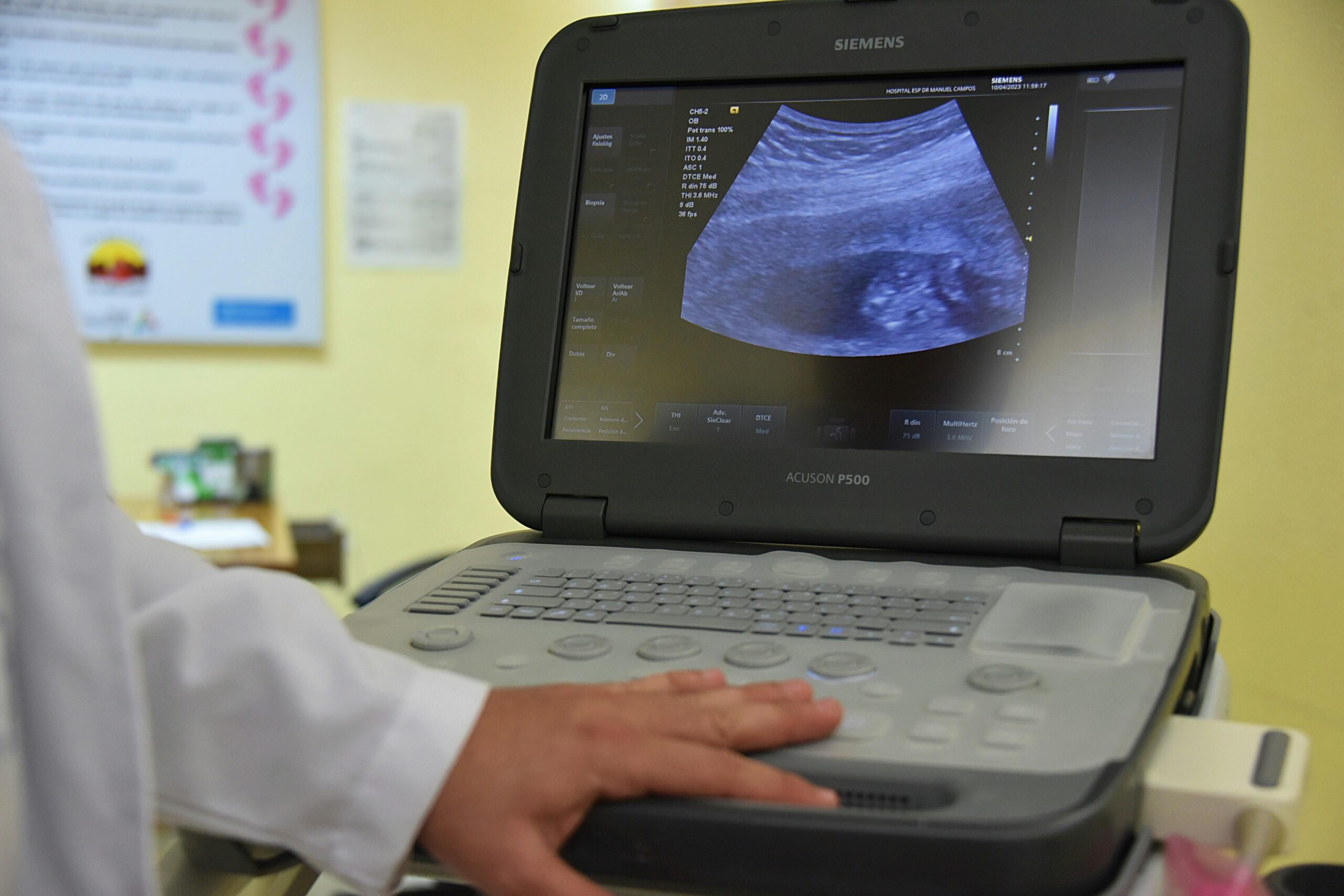 Home A close-up of a doctor performing an ultrasound scan, focusing on medical technology in practice.